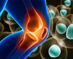 Regeneración de tejidos con células madre en enfermedades crónicas