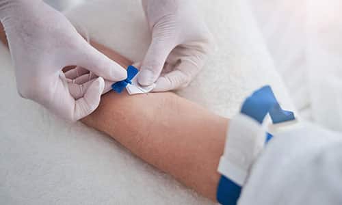 Aplicación de terapia con células madre por vía intravenosa