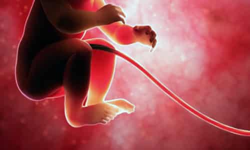 Obtención de células madre del cordón umbilical