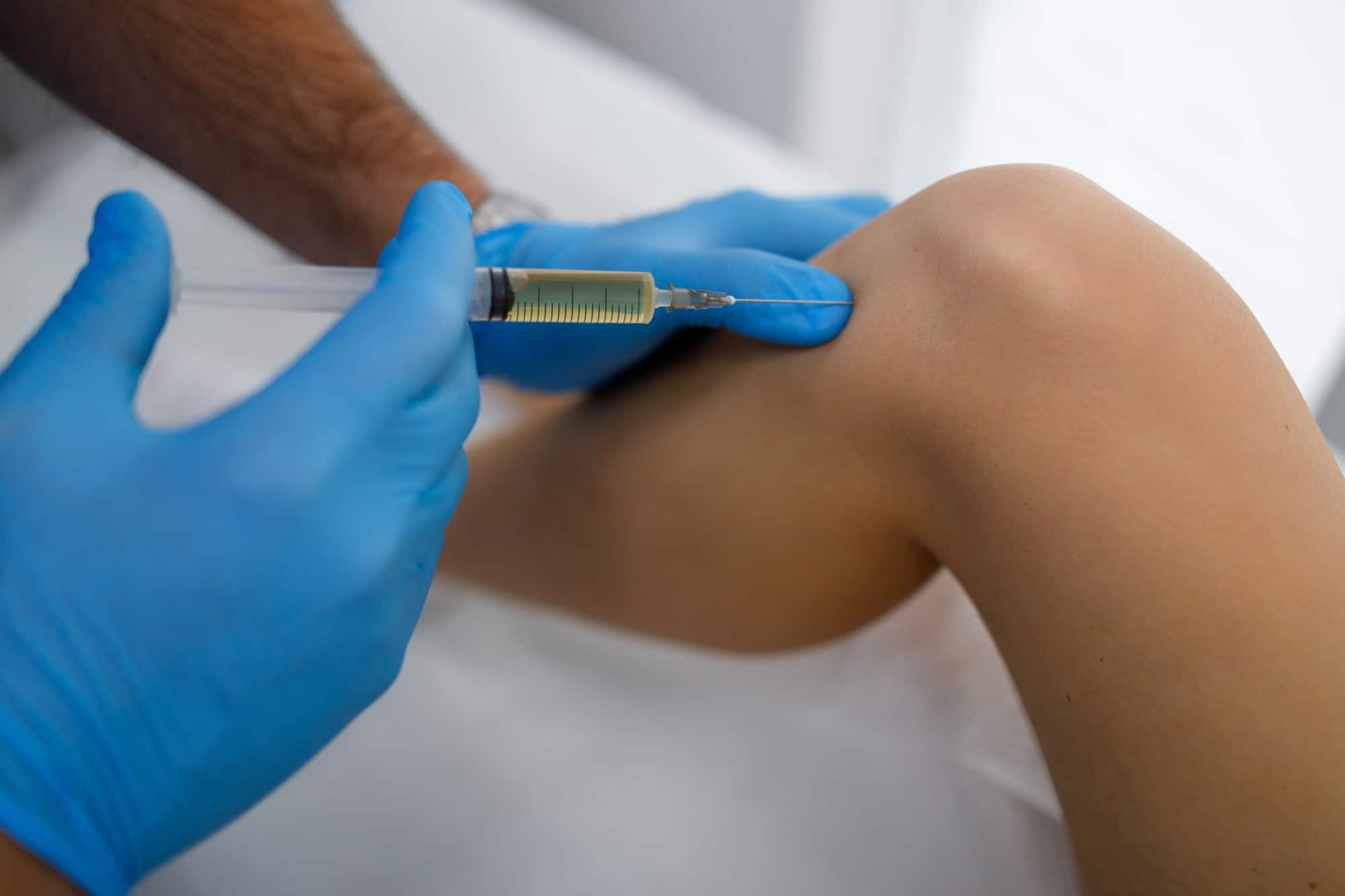 celulas madre inyectadas en la rodilla