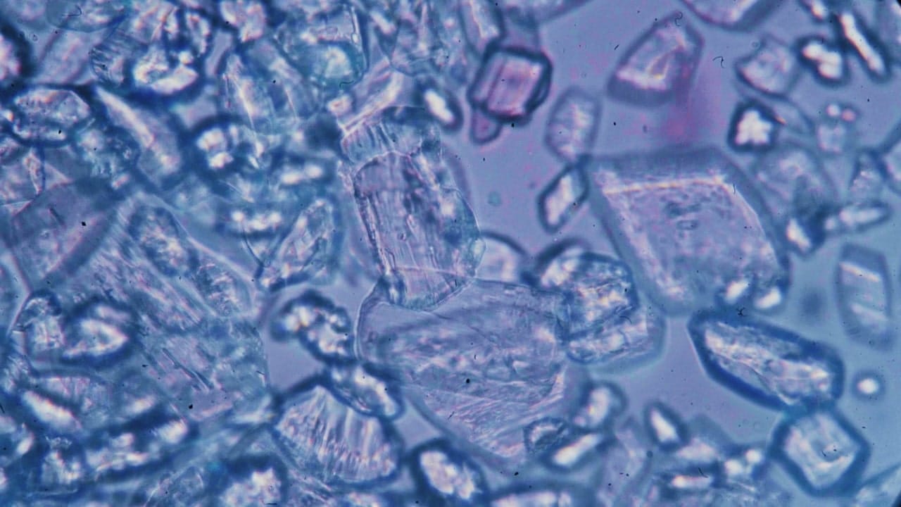 tipos de células madre