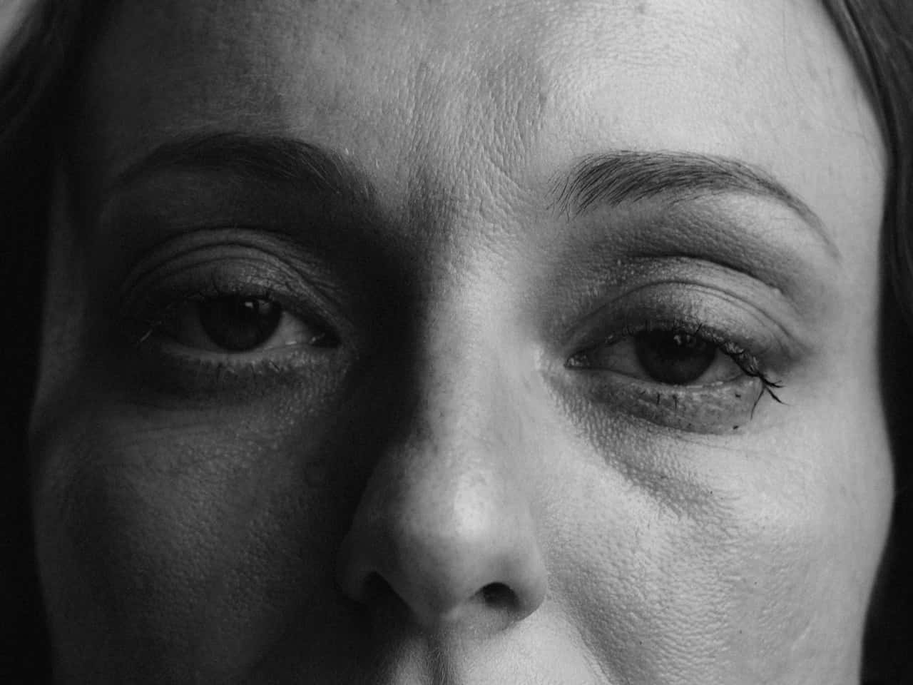 tratamiento de células madre para el cutis