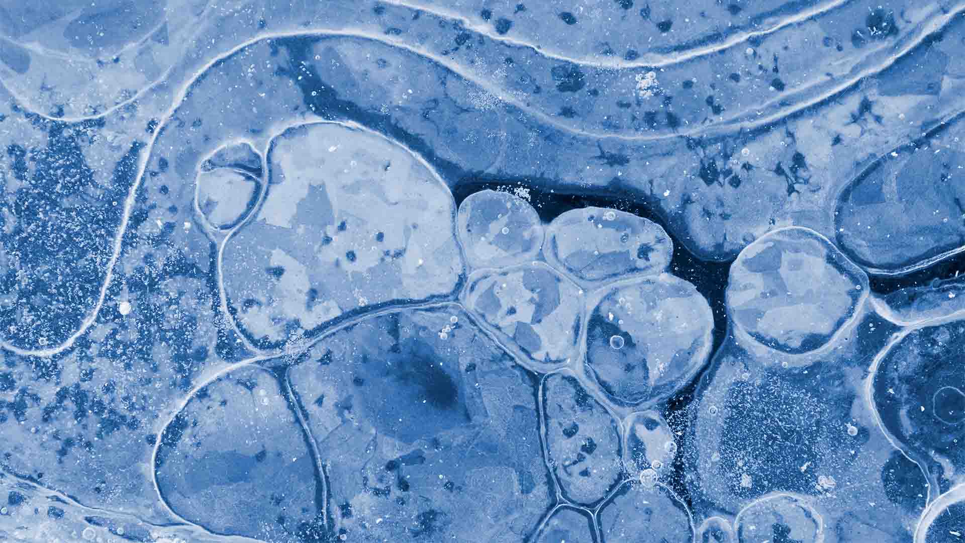 tipos de células madre